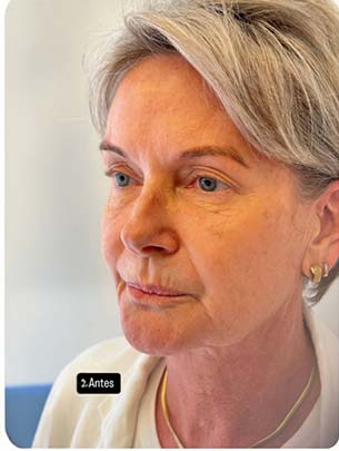 antes4 antes4